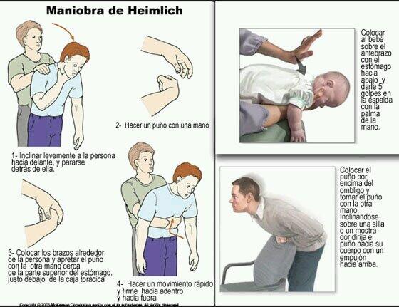 ¿Qué es y cómo realizar la Maniobra de Heimlich?